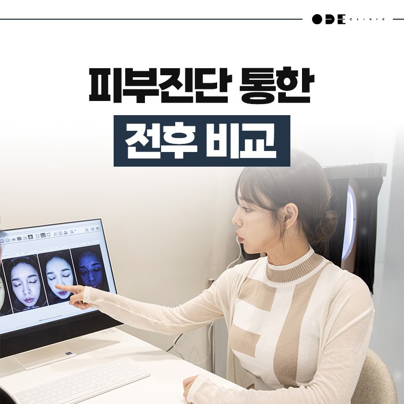personalized XERF treatment Seoul